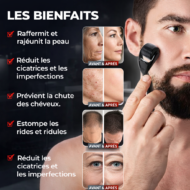 Derma Roller Barbe – Image 4